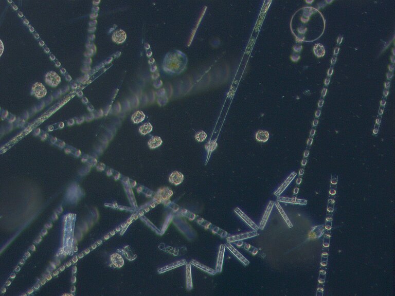 Mikroalgen erscheinen als leuchtende Bänder unter dem Mikroskop